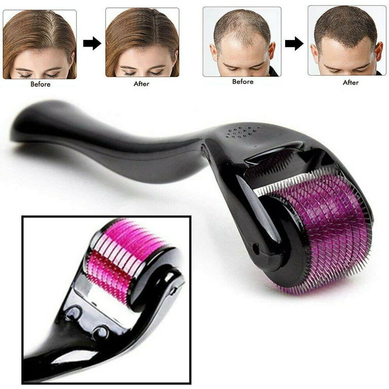 0.5mm Derma Roller with 540 Micro Needles | Hair & Skin Care Tool